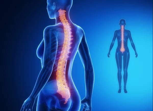 Spinal Cord Injury